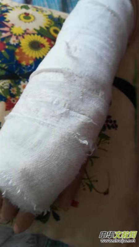 ����֠�����L(f��ng)��Ƥ͹��ۂ�ʹ��Ҳʹ