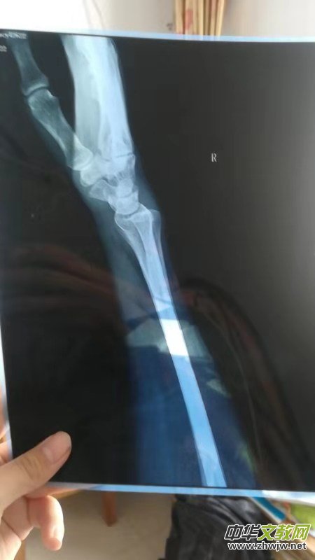 ����֠�����L(f��ng)��Ƥ͹��ۂ�ʹ��Ҳʹ