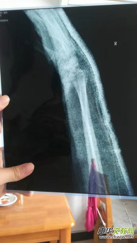 ����֠�����L(f��ng)��Ƥ͹��ۂ�ʹ��Ҳʹ