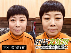 ���t(y��)�þ��ַ������ˡ�������ة