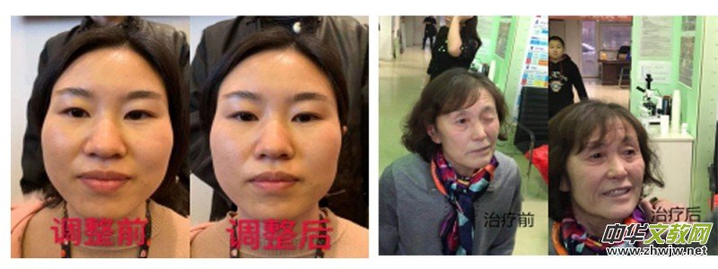 ���t(y��)�þ��ַ������ˡ�������ة