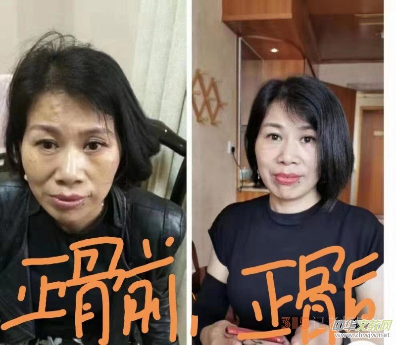 �߼�����䯟���ҷ�����